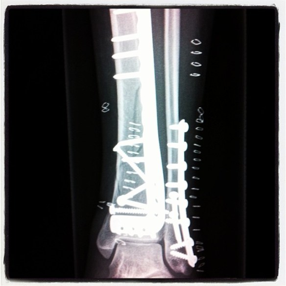 SaltyLips Womens Carmen Surf Girls Salty Lips